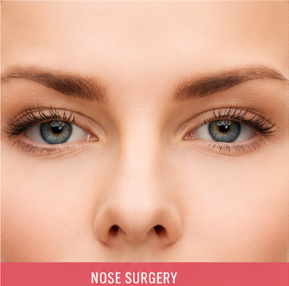 Nose Surgery